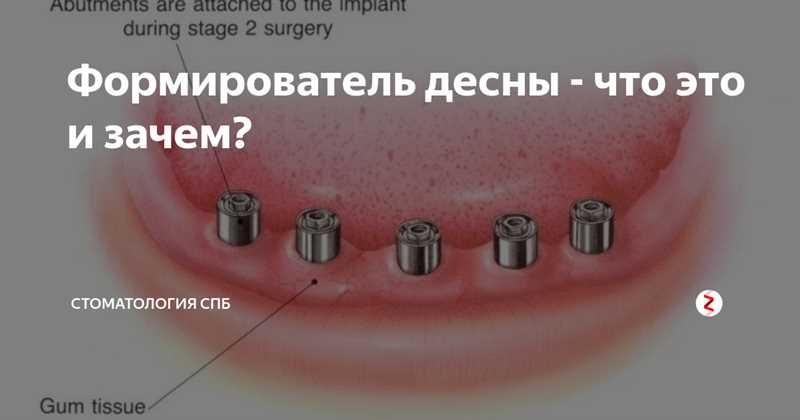 Как начать использовать Матрикснет для достижения успеха